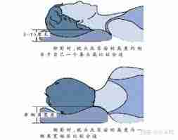选购枕头越高越好吗